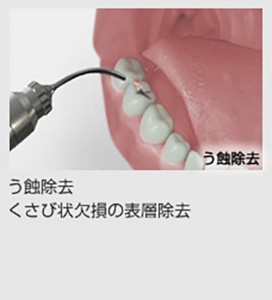 contents_img010