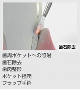 contents_img011