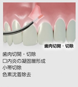 contents_img012